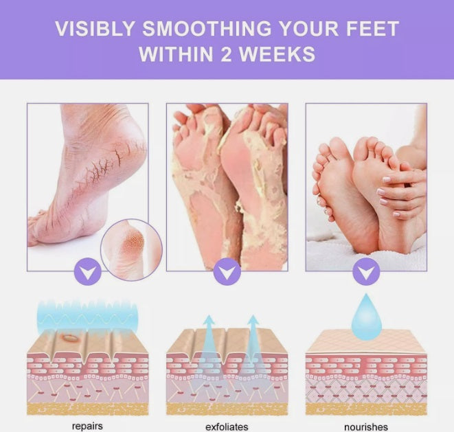 Elaimei Exfoliating Peel Foot Care Sock Mask Baby Soft Skin Feet Removes Callus Lavender