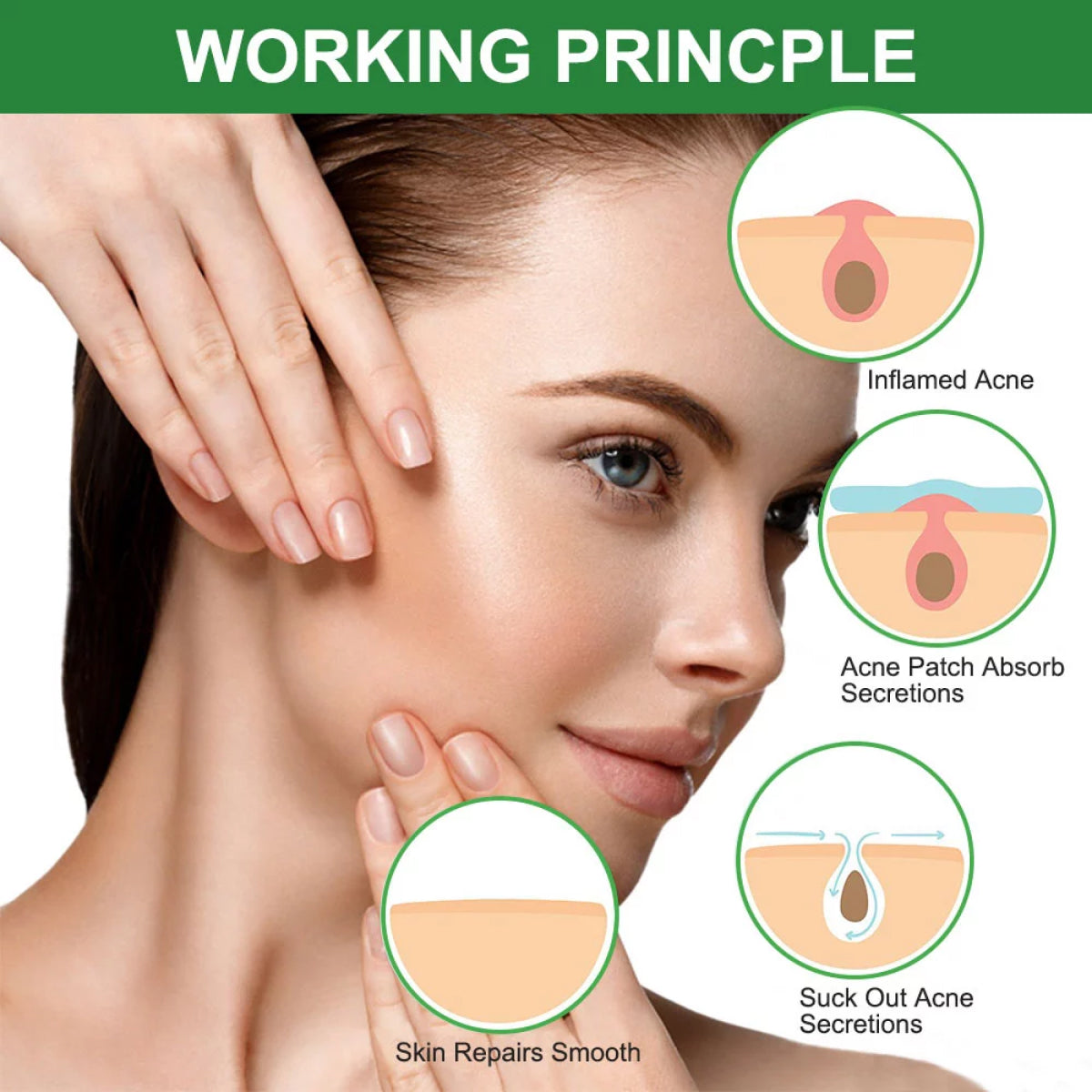 ELAIMEI Acne Pimple Removal Patch Remover Facial Care Spot Blemish Skin Tool Sticker 24