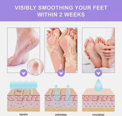 Elaimei Exfoliating Peel Foot Care Sock Mask Baby Soft Skin Feet Removes Callus Lavender