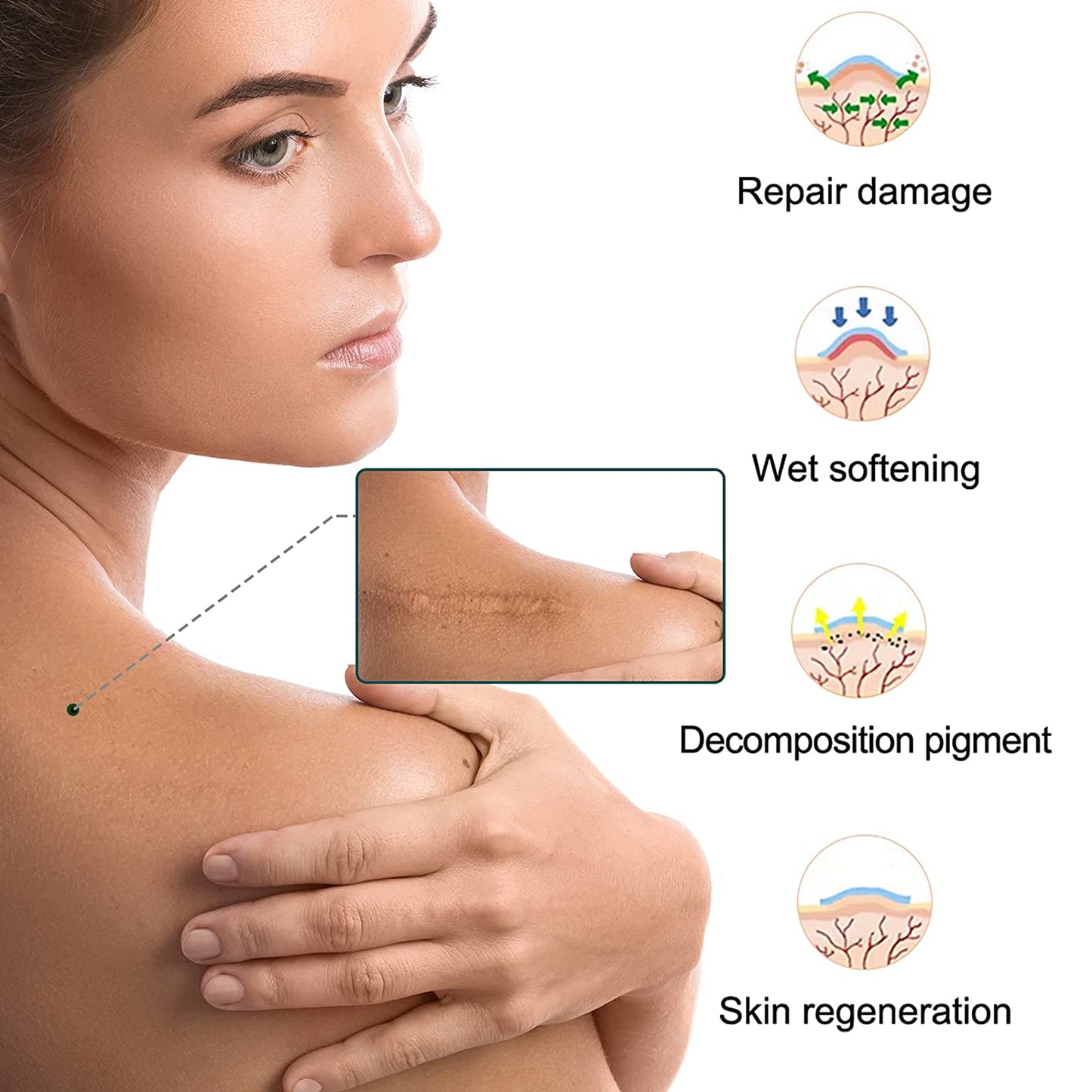 Elaimei Silicone Gel Sheet Patch Scar Removal Wound Skin Repair Treatment Remover Keloid Surgery - 3M Long