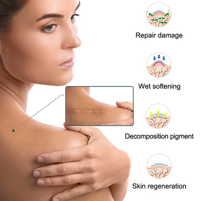 Elaimei Silicone Gel Sheet Patch Scar Removal Wound Skin Repair Treatment Remover Keloid Surgery - 3M Long