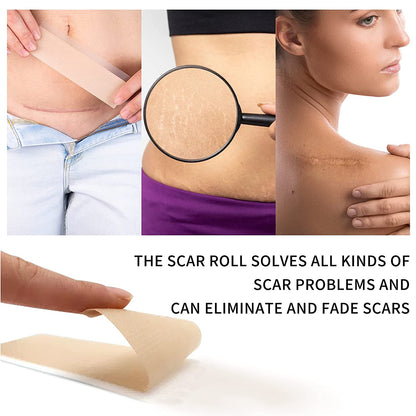 Elaimei Silicone Gel Sheet Patch Scar Removal Wound Skin Repair Treatment Remover Keloid Surgery - 3M Long