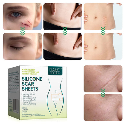 Elaimei Silicone Gel Sheet Patch Scar Removal Wound Skin Repair Treatment Remover Keloid Surgery - 3M Long