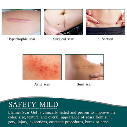 Elaimei Silicone Gel Sheet Patch Scar Removal Wound Skin Repair Treatment Remover Keloid Surgery - 3M Long