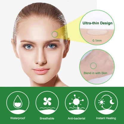 ELAIMEI Acne Pimple Removal Patch Remover Facial Care Spot Blemish Skin Tool Sticker 24