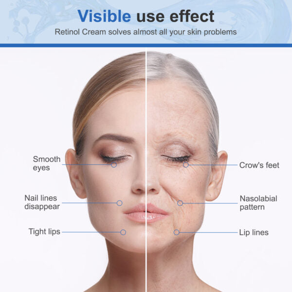 Elaimei Pure Retinol Face Cream 2,5% Anti Aging Wrinkles Moisturizer Acne Facial Repair Reduce